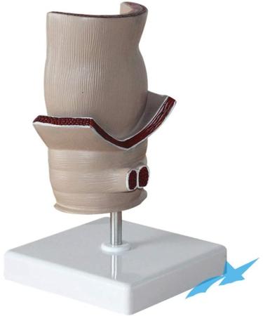 Rectum Model Human Pathological Diseases Rectum Ulcus Acne Pathological Model Use for Model Hemorrhoid Model Demonstration of Anorectal Diseases - Buy Online on GoSupps.com