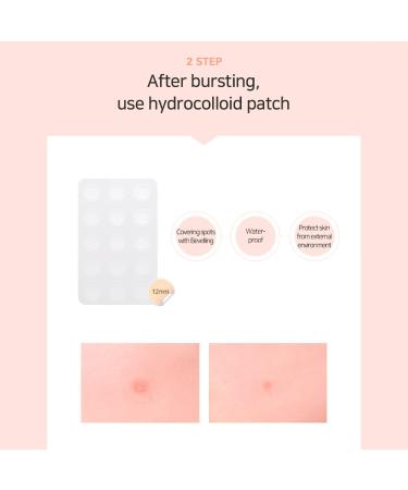 RNW Der. Esthe Dual Derm Spot Patch Set - Hydrocolloid Acne Blemish Covers (70EA) | Invisible Pimple Care | Korean Skincare for All Day Use - Buy Online on GoSupps.com