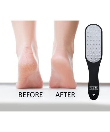 Fac n Professional 3-in-1 Pedicure Foot File - Premium Callus Remover & Mini File | Surgical Grade Stainless Steel for Smooth Feet - Buy Online on GoSupps.com