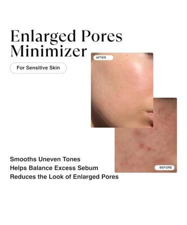 LAYRONIX Niacinamide Serum for Face Antioxidant Ampoule - for Excess Oil Large Pores Uneven Skin Tone Dullness - Centella Asiatica + Ceramides + Vitamin E + Hyaluronic Acid + Beta-Glucan - Buy Online on GoSupps.com
