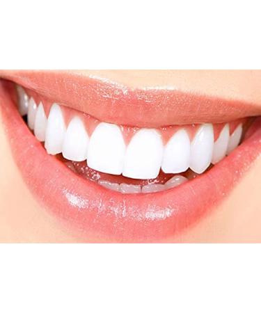 Finafta Oral Anesthetic: Treatment for Canker Sores & Mouth Irritations - Buy Online on GoSupps.com