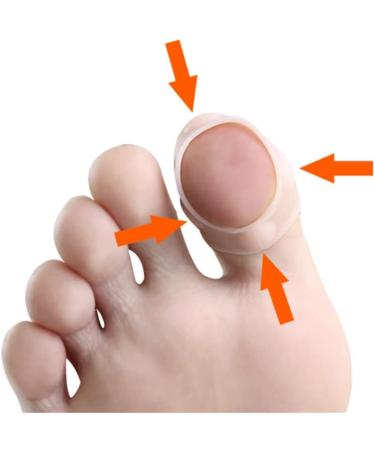 Ingrown Toenail Corrector Sleeves 4 Pairs Elastic Silicone Ingrown Toenail Correction Tool Thick Paronychia Treatment Corrector Big Toe Sleeves Toe Nail Healing Care Protector for Keep Nail Healthy - Buy Online on GoSupps.com