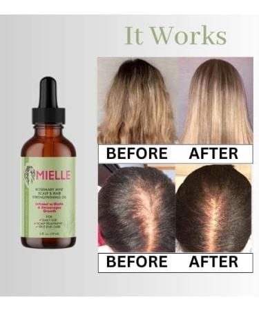 Rosemary Mint Scalp & Hair Oil 2oz 100% Pure Organic Rosemary Essential Oils Good for Hair Loss Treatment stimulates Hair Growth and Aromatherapy for Men and Women + 2 Eyelash Brushes With Eyelash Brushes - Buy Online on GoSupps.com