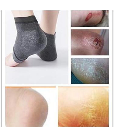 Buy Spa Socks | Moisture-Span Gel Socks for Dry Cracked Feet | Black Foot Care & Protection - Buy Online on GoSupps.com