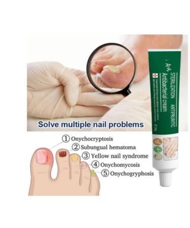 Moisturizing Antipruritic Ointment for Dry Skin Peeling on Hands and Feet - Buy Online on GoSupps.com