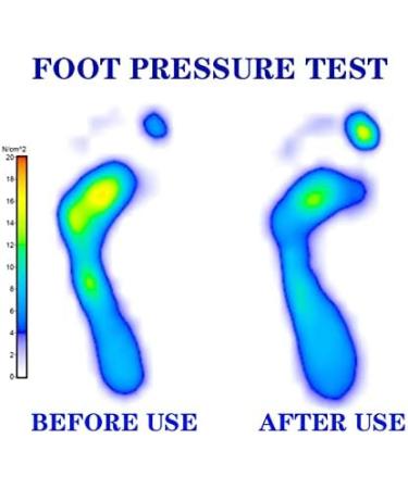 Plantar Fasciitis Relief Insoles - Arch Support Orthotics for Women & Men, XL Size, Blue, Heel Pain, Flat Feet, High Arches, Overpronation - Men's 11-13 / Women's 12-14 - Buy Online on GoSupps.com
