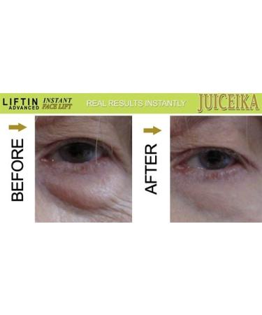 "LIFTIN Advanced" INSTANT FACE LIFT by Juiceika. This is an INCREDIBLE 60 Second FACE LIFT! - Buy Online on GoSupps.com