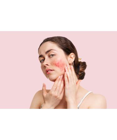 DERMAFLAGE COVERAGE+ Rosacea Cream with Full Coverage Makeup for Redness Relief (Light) - Buy Online on GoSupps.com
