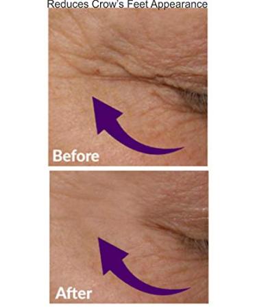 Eye Control Serum - Lift & Tighten Eyelids Reduce Dark Circles Fine Lines & Puffiness - International Shipping Available - Buy Online on GoSupps.com