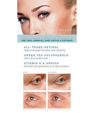 Under Eye Repair Cream with All-Trans-Retinol for Dark Circles, Puffiness & Wrinkles - 0.5 Oz - Buy Online on GoSupps.com