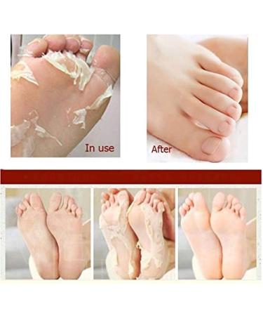 Balea Callus Remover Socks - Effective Callus Removal | 1 Pair (2 Pieces) for Soft Smooth Feet - Buy Online on GoSupps.com