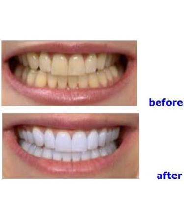 Professional Portable Teeth Whitening Machine with LED Accelerator Light - YS-TW-A - Buy Online on GoSupps.com