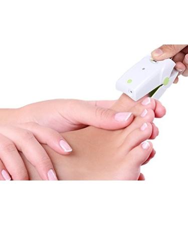 Ncure Nail Fungus Onychomycosis Fungal Remover The Most Efficient Rechargeable Laser Device Treatment for Home Use + Skin Fungus Dermatitis Cream Fungal Infection Treatment