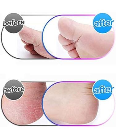 XBSXP Pedicure 10-Piece Electric Foot Grinder Replacement Heads - Black | International Shipping Available - Buy Online on GoSupps.com