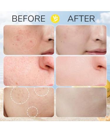 Turmeric Kojic Acid Pads - 2024 Exfoliating Cleansing Pads for Radiant Skin (40PCS - Buy Online on GoSupps.com