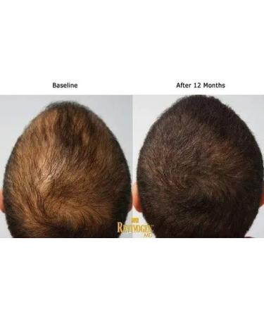 Revivogen Hair & Leather Treatment 60 ml - International Shipping Available - Buy Online on GoSupps.com