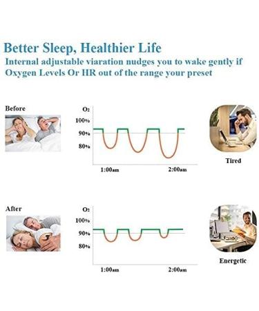 Buy Smart Sleep Monitor with App - Bluetooth Vibration Alarm Heart Rate Tracking & Overnight Reports - Buy Online on GoSupps.com