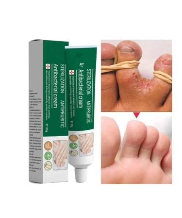 Moisturizing Antipruritic Ointment for Dry Skin Peeling on Hands and Feet - Buy Online on GoSupps.com