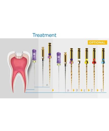 M-Taper NiTi Engine Large Tapered Rotary Files 21mm - Pack of 6 (Assorted Sizes DX-M3 & SX-F3) | International Shipping Available - Buy Online on GoSupps.com