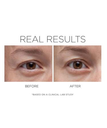 COSMEDIX Opti Crystal Liquid Crystal Eye Serum 0.25 Fl Oz | Reduce Dark Circles | Improve Fine Lines & Wrinkles | Cruelty-Free & Gluten Free - Buy Online on GoSupps.com