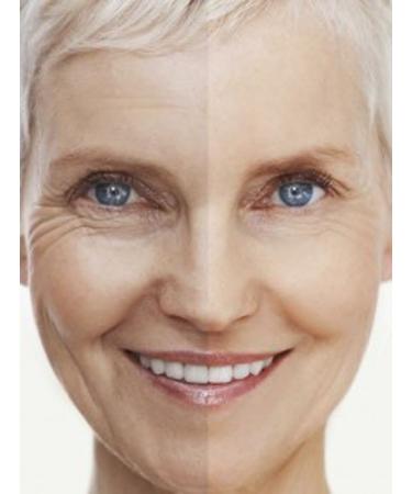 DNA Code -No Needle Alternative-Pure Argireline Peptides Winkle Reduce Cream-Hyaluronic Acid+ Matrixyl 3000 2 Fl Oz (Pack of 1) - Buy Online on GoSupps.com