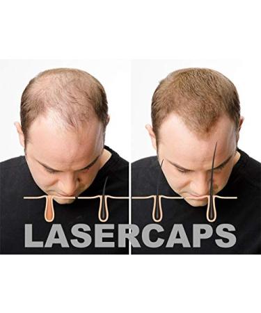 Buy Laser Caps for Hair Growth | International Shipping Available - Buy Online on GoSupps.com