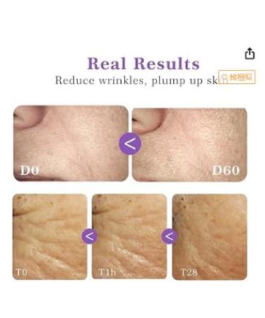 Optimized Meta Title: "Dark Spot Corrector & Matrixyl 3000 Serum - Collagen Booster & Niacinamide HPR for Plump Skin (YELLOW PURPLE - Buy Online on GoSupps.com