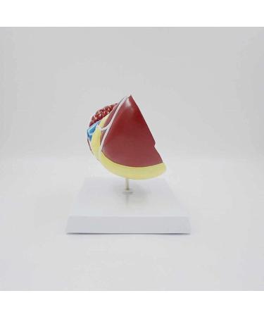 Liver Damage ical Model Liver Pathology Models Teaching Aids - 22.5 * 17 * 16CM - Buy Online on GoSupps.com