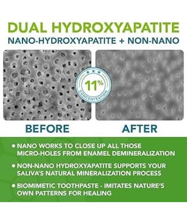100% Pure Nano Hydroxyapatite Tooth Powder Enamel Remineralization Support, Fluoride-Free Toothpaste Additive for Sensitivity & Cavity Defense, Pure HAp Powder 30g 1.06 Ounce (Pack of 1) - Buy Online on GoSupps.com