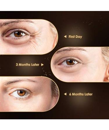Mylansea Anti Aging Eye Cream with Retinol, Niacinamide & Hyaluronic Acid - 1 Oz | Reduces Wrinkles, Puffiness & Dark Circles - Buy Online on GoSupps.com