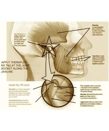 Theraflex Rx TMJ Relief - Doctor Formulated Patented Topical Solution for Head, Jaw Joint, and Muscle Relief - Buy Online on GoSupps.com
