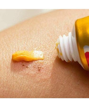 Natural Psoriasis & Eczema Treatment Cream | Healthy Skin Moisturizer - Buy Online on GoSupps.com