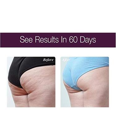 Osmotics Anti-Aging Body Lift Serum - Firming Age-Defying Treatment for Bust Belly & Behind - Dermatologist Recommended - Shop Internationally - Buy Online on GoSupps.com