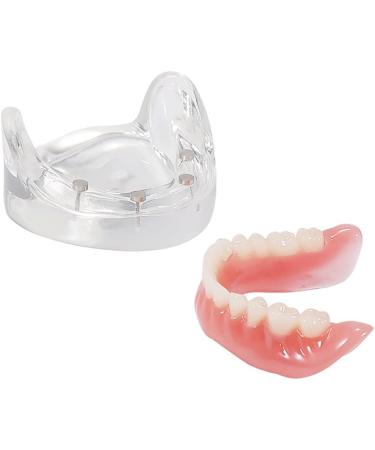 COMDS Dental Implant Model & Removable Dentures for Educational Use | 4 Nail Implant Demo Models - Buy Online on GoSupps.com
