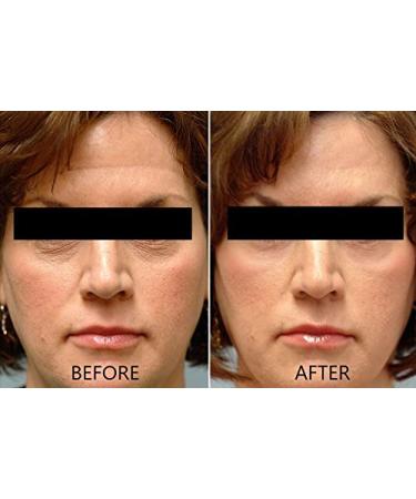 Dr. Brenner Vitamin C Serum - 20% L-Ascorbic Acid with Hyaluronic Acid & Vitamin E - Natural Beauty Serum for Face - 1oz - Buy Online on GoSupps.com