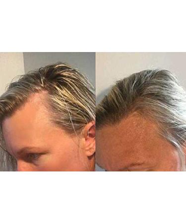 Zenagen Revolve Thickening Hair Loss Shampoo for Women - 6 Fl Oz - Buy Online on GoSupps.com