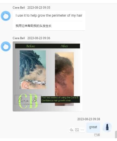 Hair Growth Elixir Oil - 100% Pure Organic Rosemary Castor Almond Oil Serum for Men & Women - Effective Hair Loss Treatment - 1.69 Fl Oz - Buy Online on GoSupps.com