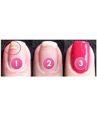 5ml Instant Cracked Nail Repair Gel - Nail Strengthener & Phototherapy Glue - Restore Weak, Broken, & Damaged Nails - Fast Fix for Nail Cracks - 1pc - Buy Online on GoSupps.com