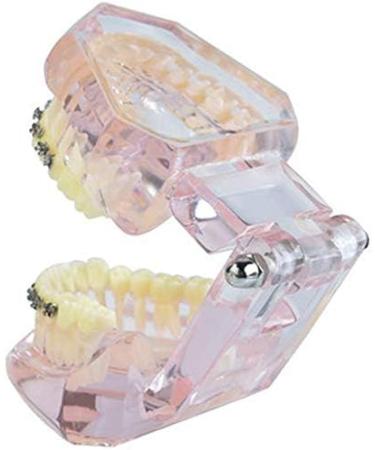 LBYLYH Pink Teeth Model - Orthodontic Dental Studio Educational Toy for Kids - Buy Online on GoSupps.com
