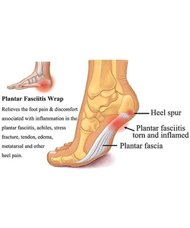 Feegow Plantar Fasciitis Relief Compression Cuffs | Foot Care Inserts & Support for Pain Relief - Buy Online on GoSupps.com
