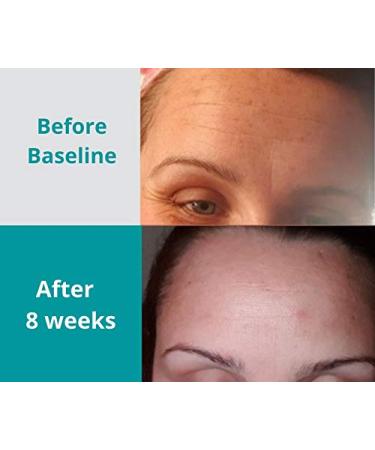 Retinol Night Moisturizer Cream 0.05% with Jojoba Oil, Tea Extract, and Vitamin E - Anti Aging & Firming Cream for Women - 20g - Buy Online on GoSupps.com