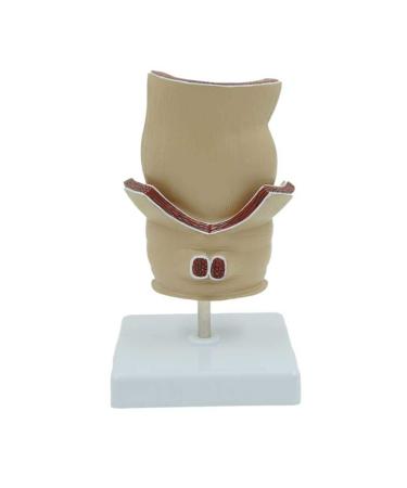 Humanly Rectal Hemorrhoid Lesions Anatomical Model Dilkpunkt Anal Anorectal