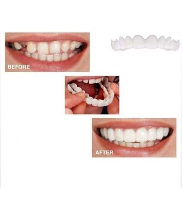 Clip-In Veneers Teeth - Instant Smile Temporary Dentures for Men & Women | Upper & Lower False Teeth Snap-On Cover - Buy Online on GoSupps.com