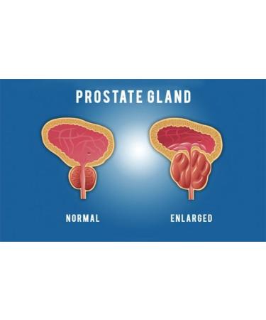 Pulean Formula - Natural Enlarged Prostate Support Winner of 5 Awards. 240 Tablets - Buy Online on GoSupps.com