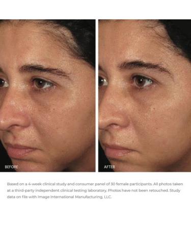 IMAGE Skincare ORMEDIC Biopeptide Cr me 2oz - Buy Online - Buy Online on GoSupps.com