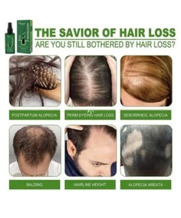 Anti-Hair Loss Spray | Hair Nutrient Solution 120 ml - Boost Hair Growth & Strengthen Thinning Hair - Buy Online on GoSupps.com
