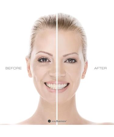 VON BARONESS Anti-Aging Face Cream - with White Caviar Extract Retinol Collagen and Hyaluronic Acid - Reduce Wrinkles and Fine Lines Deeply Hydrate Cream - Buy Online on GoSupps.com