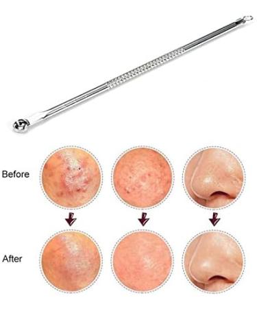 Piuruf Stainless Steel Acne Needle - Blackhead & Comedone Remover Tool for Clear Skin | International Shipping Available - Buy Online on GoSupps.com