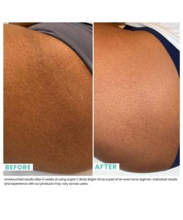 Urban Skin Rx Super C Body Bright Oil - Brightening & Nourishing Skincare for Glowing Skin Reduces Scars & Discoloration Cruelty-Free 4 Fl Oz - Buy Online on GoSupps.com
