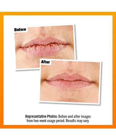 OKeeffe's Lip Repair Tube - Cooling Relief 8ml | Best Soothing Lip Balm for Dry Lips - International Shipping Available - Buy Online on GoSupps.com